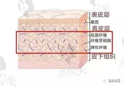 皮下组织修复