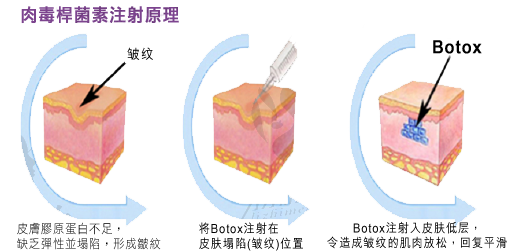 20161029114575547554.png