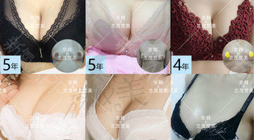 北京京韩王沛森自体脂肪隆胸，增加1-2罩杯以上丰胸2万余案例，32年丰胸整形经验