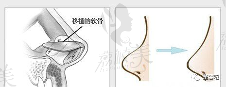 揭示！为什么鼻头<span style=