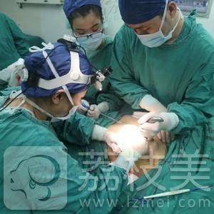 上海时光整形外科主任张晶假体隆胸案例