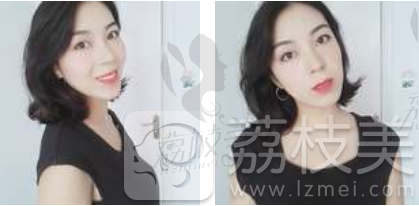 哈尔滨斯美诺范伟提升案例