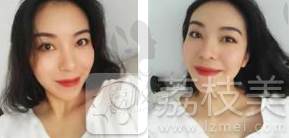 哈尔滨斯美诺范伟提升案例
