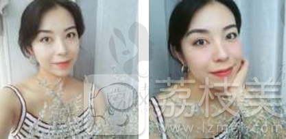 哈尔滨斯美诺范伟提升案例