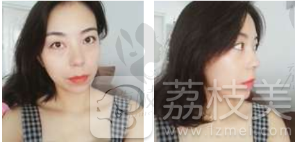 哈尔滨斯美诺范伟提升案例