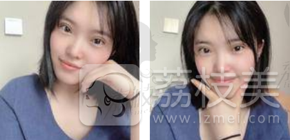 我终于知道了杭州艺星日式审美眼综合的水平！强力推荐哦！
