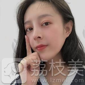 杭州时光陈小平眼综合案例