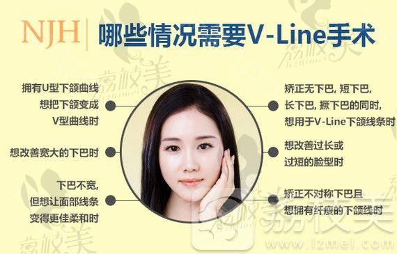 那些情况需要做V-LINE手术