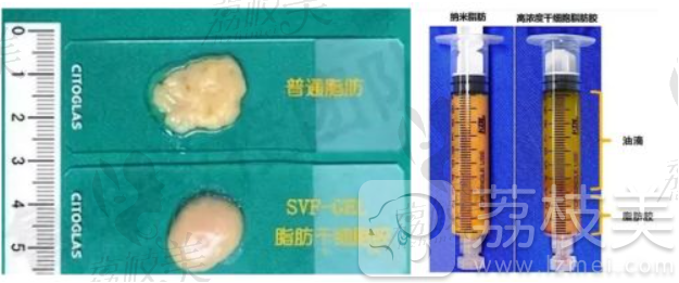 脂肪胶于脂肪的区别