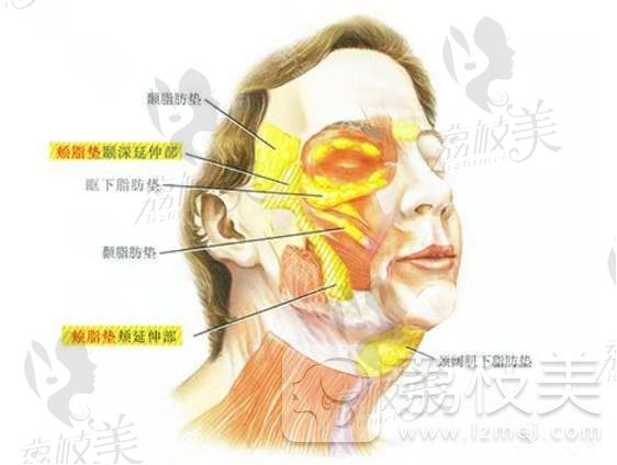 原辰整形外科双下巴吸脂，3.6K即刻拥有年轻小V脸