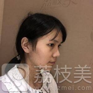 四川华美紫馨陈杨鼻综合