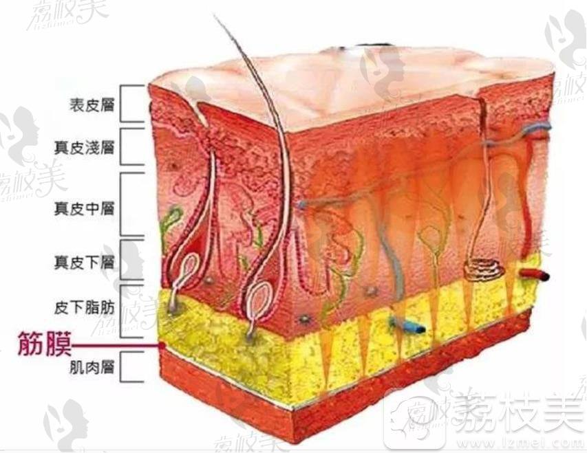 清潭FIRST小切口从筋膜层提拉