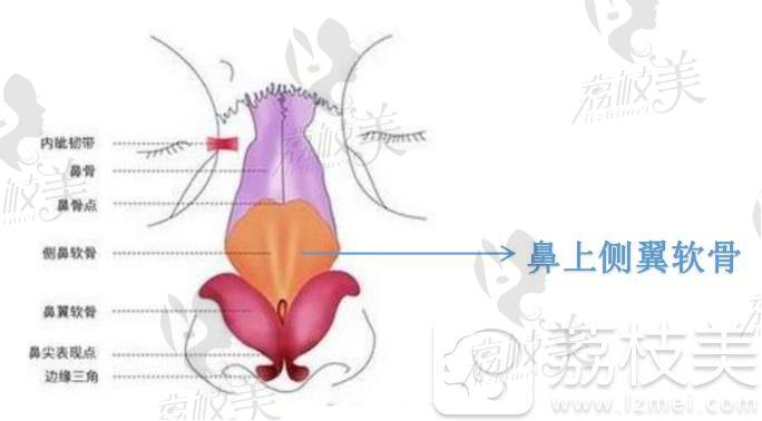 清潭FIRST鼻上侧翼软骨隆鼻