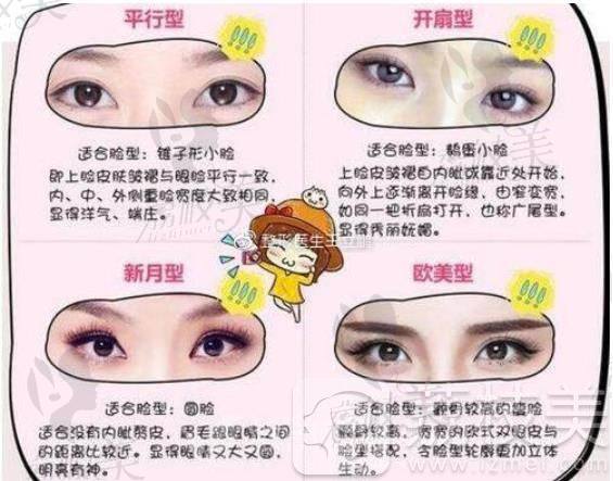 不同双眼皮适合不同人群