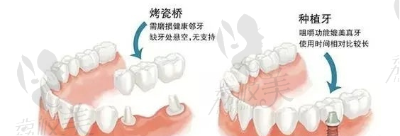 长沙美奥口腔医院韩国种植牙价格2025