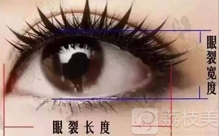 根据眼部特点设计双眼皮