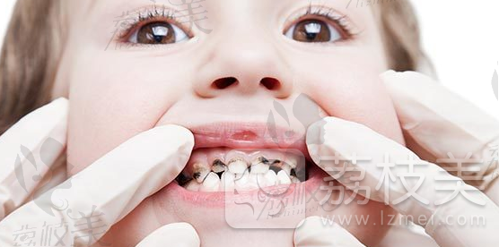 中山小榄镇维尔口腔提醒牙病拖延症患者，越拖你花钱越多