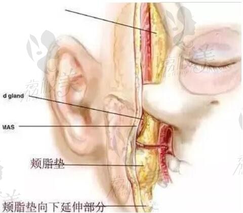 关于取颊脂垫的五大灵魂拷问，看完再决定做不做