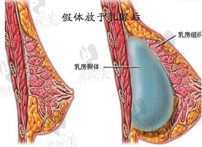 ​听说按摩胸就会变大？难道是真的？