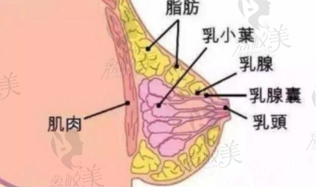 脂肪丰胸PK假体隆胸，选哪一个好？