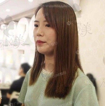 手术后