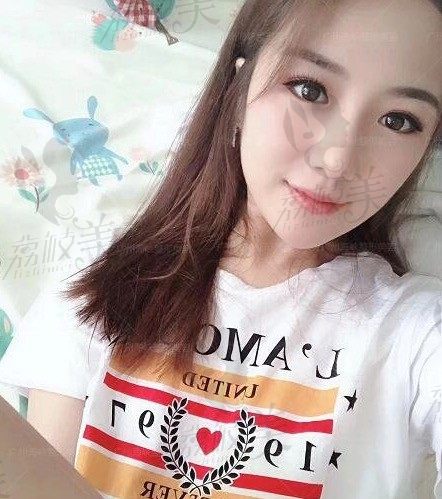 手术前
