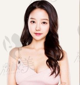 韩国VG百利酷任荣旻眼部修复+隆胸手术真人案例，效果超棒