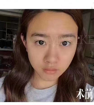 在西安美莱找曾熬院长做了