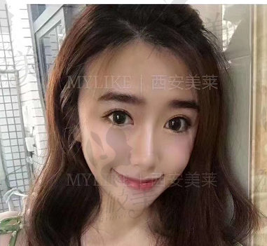 手术前