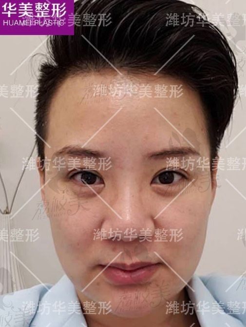 手术前