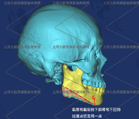 手术前