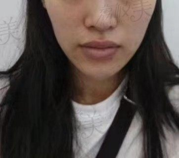 手术前