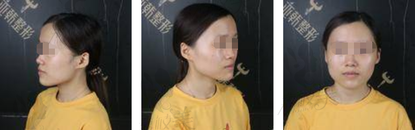 手术前