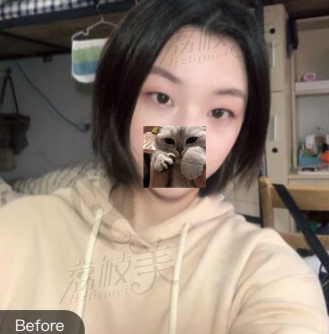 手术前