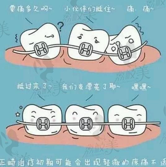 矫正牙齿是否很痛？看看爱牙博主周绍楠博士怎么说？