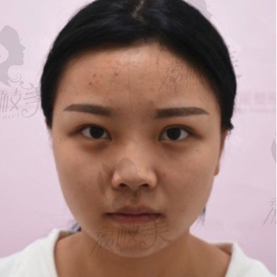 手术前