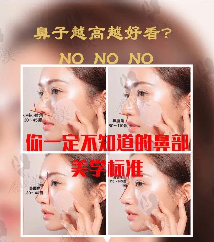 提升美商，苏州美莱张亮医师分享隆鼻，鼻部美学小知识