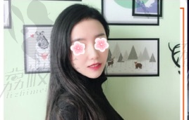 苏州薇琳张宇忠EMA脂肪移植面部有什么特色？