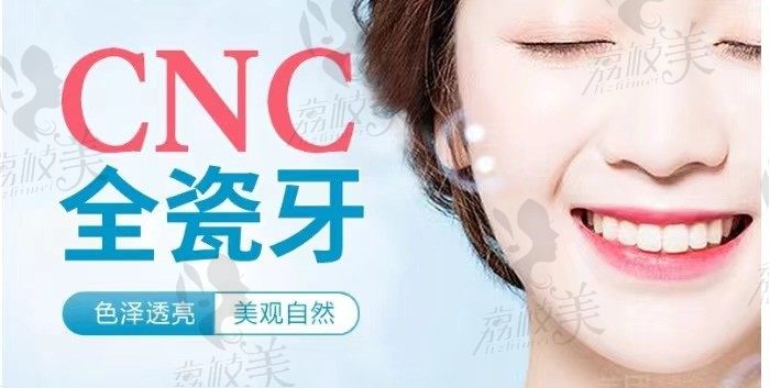 武汉大众口腔CNC全瓷牙优势是什么？