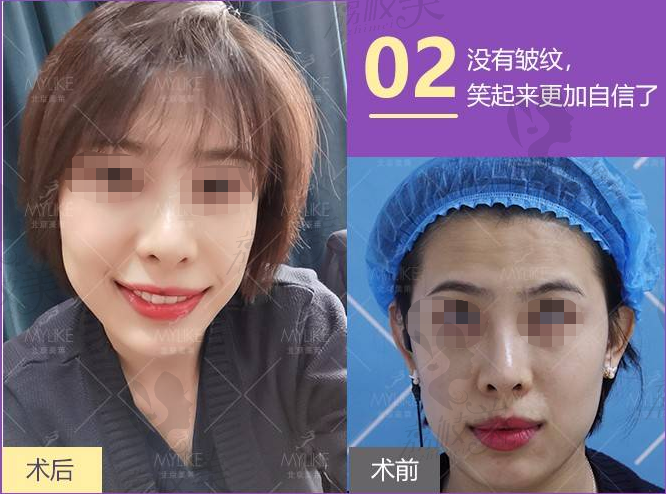 保妥适