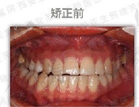 手术前