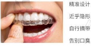 重庆韩佳牙博士时代天使牙齿矫正多少钱，会改变脸型吗？