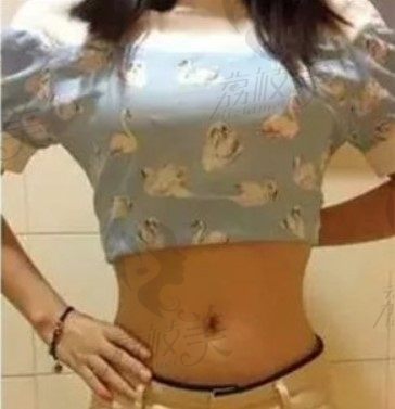 哈尔滨双燕医美多维腰部