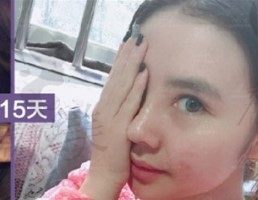 什么样的鼻子