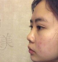 手术前