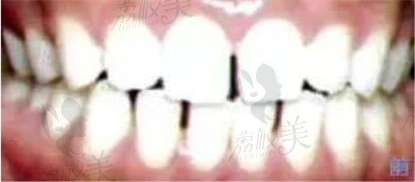 手术前