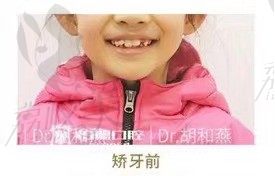 手术前