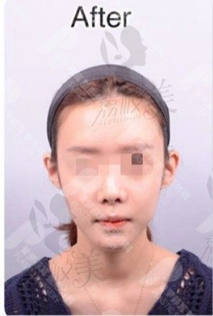 手术前