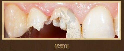 手术前