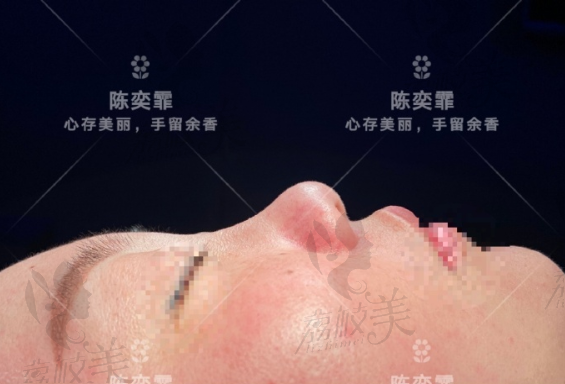 手术前